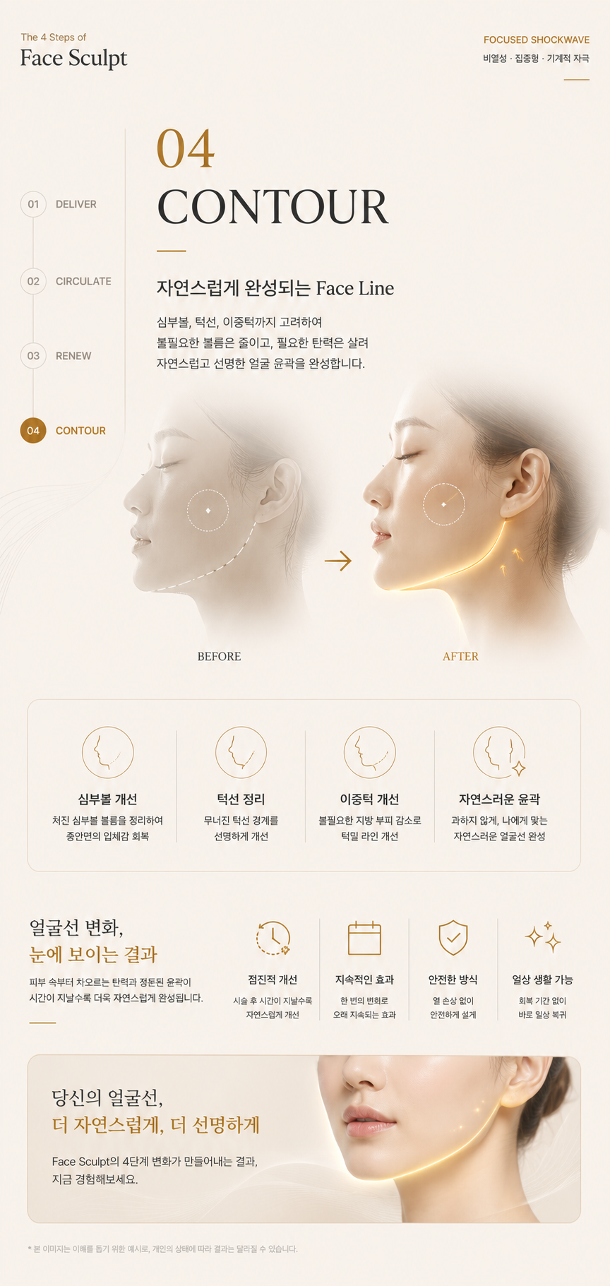 더 차오름의원 :: 얼굴근막 리프팅관리