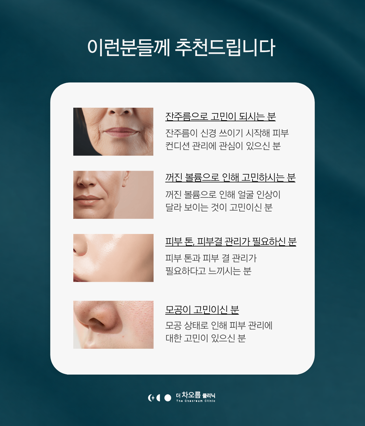 더 차오름의원 :: 덴서티
