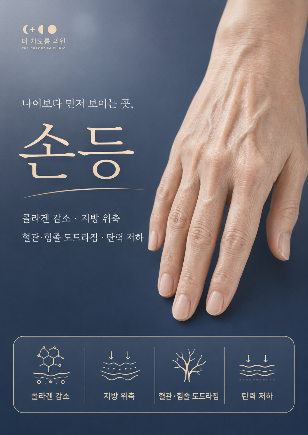 더 차오름의원 :: 손등 레디어스