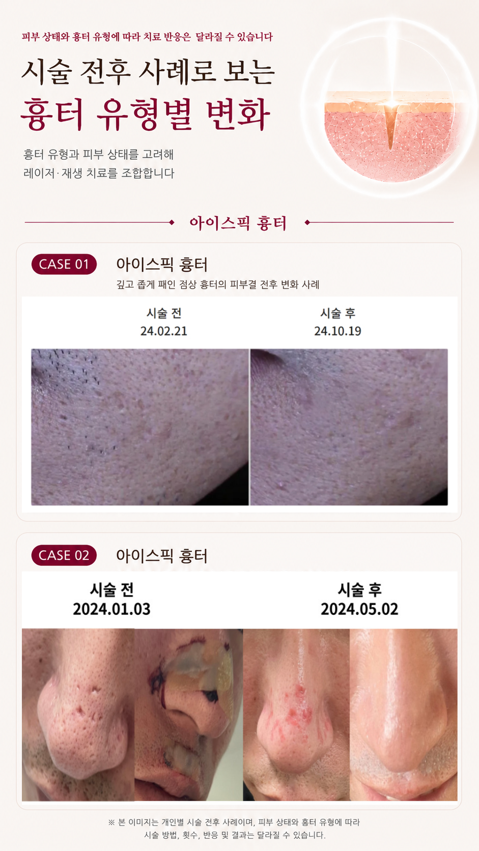 더 차오름의원 :: 더차오름 시그니처 흉터치료 프로그램 