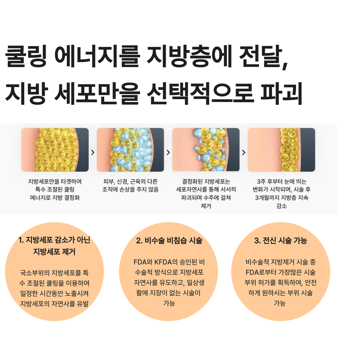 더 차오름의원 :: 쿨스컬프팅 (젤틱)