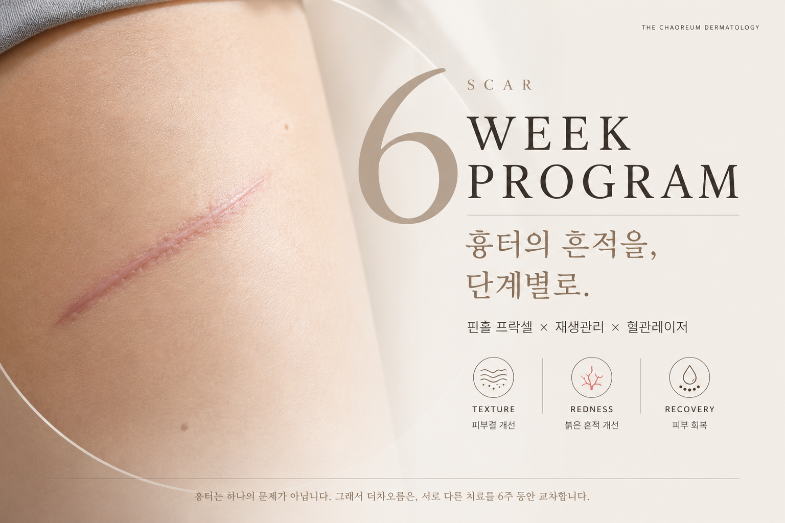 더 차오름의원 :: 흉터 리페어 6주 프로그램