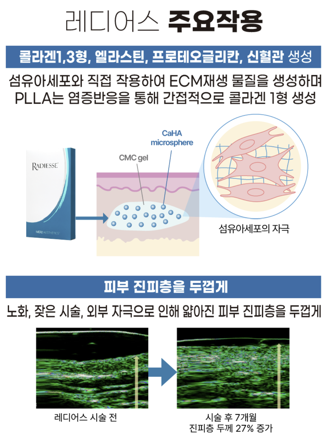 부산피부과 | 더차오름의원 부산점 - 리프팅, 보톡스, 피부레이저 :: 레디어스