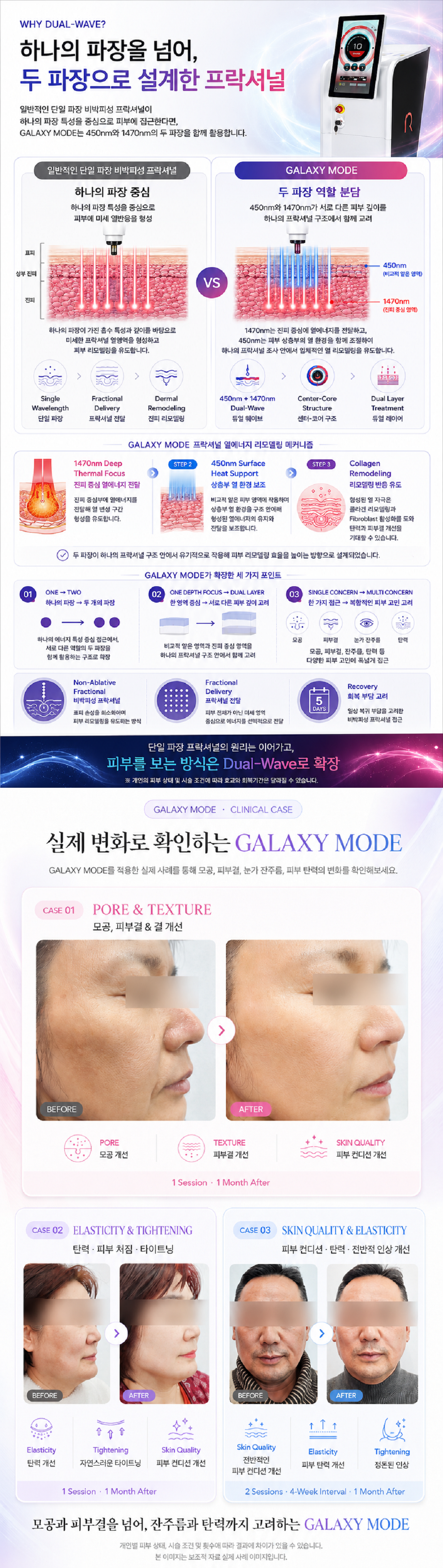 부산피부과 | 더차오름의원 부산점 - 리프팅, 보톡스, 피부레이저 :: 갤럭시 레이저 (갤럭시 모드)