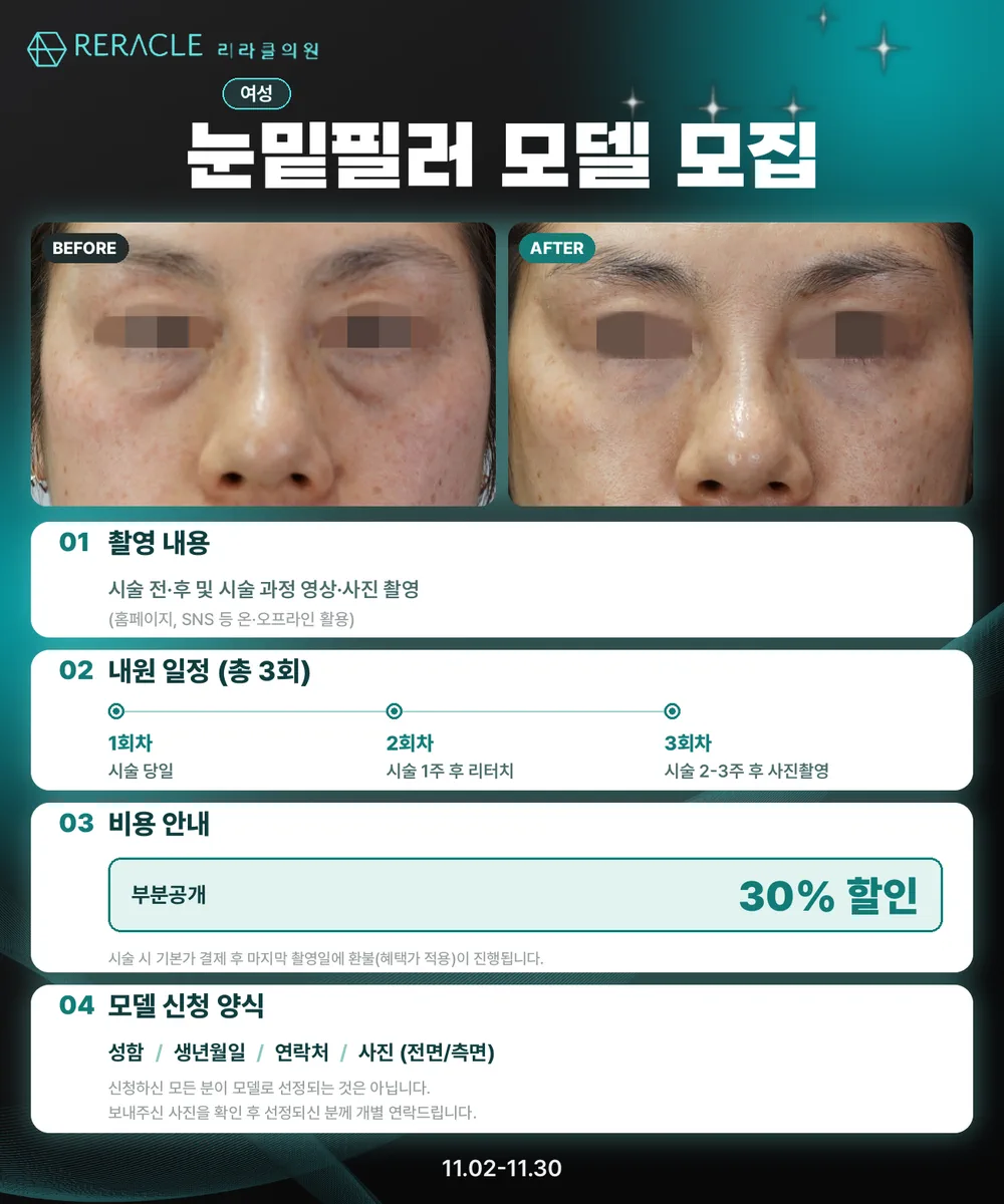 🤍눈밑필러모델 모집🤍