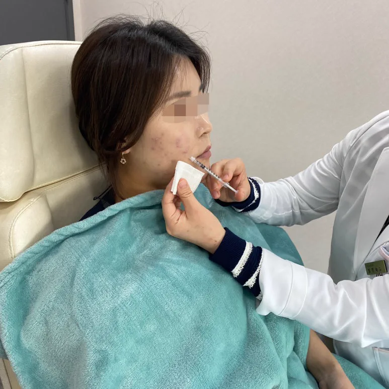 리라클의원 청주 피부과 진료 (보톡스, 필러, 리프팅) :: 색소 시술 팁