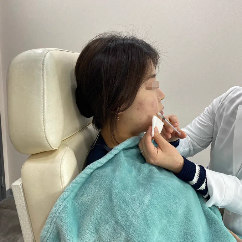 리라클의원 청주 피부과 진료 (보톡스, 필러, 리프팅) :: 색소 시술 팁