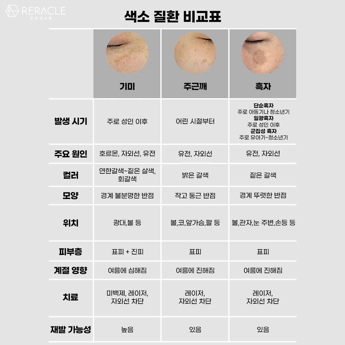 리라클의원 청주 피부과 진료 (보톡스, 필러, 리프팅) :: 색소 시술 팁