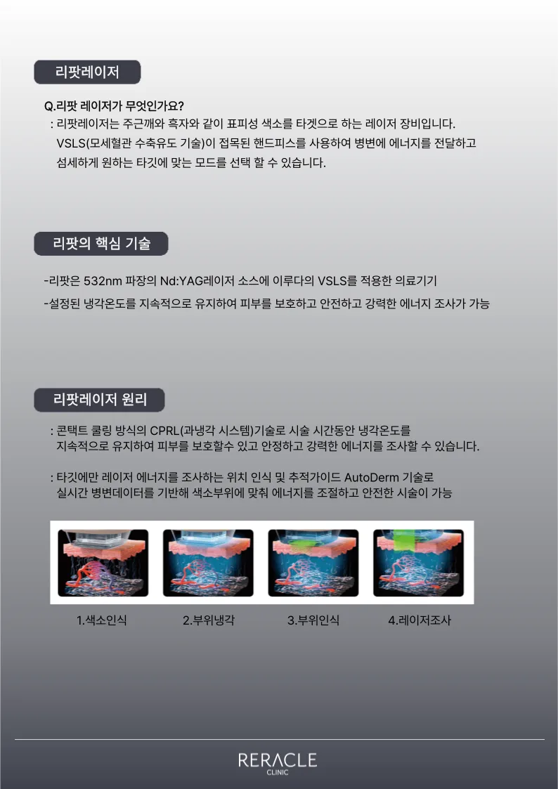 리라클의원 청주 피부과 진료 (보톡스, 필러, 리프팅) :: 색소 시술 팁