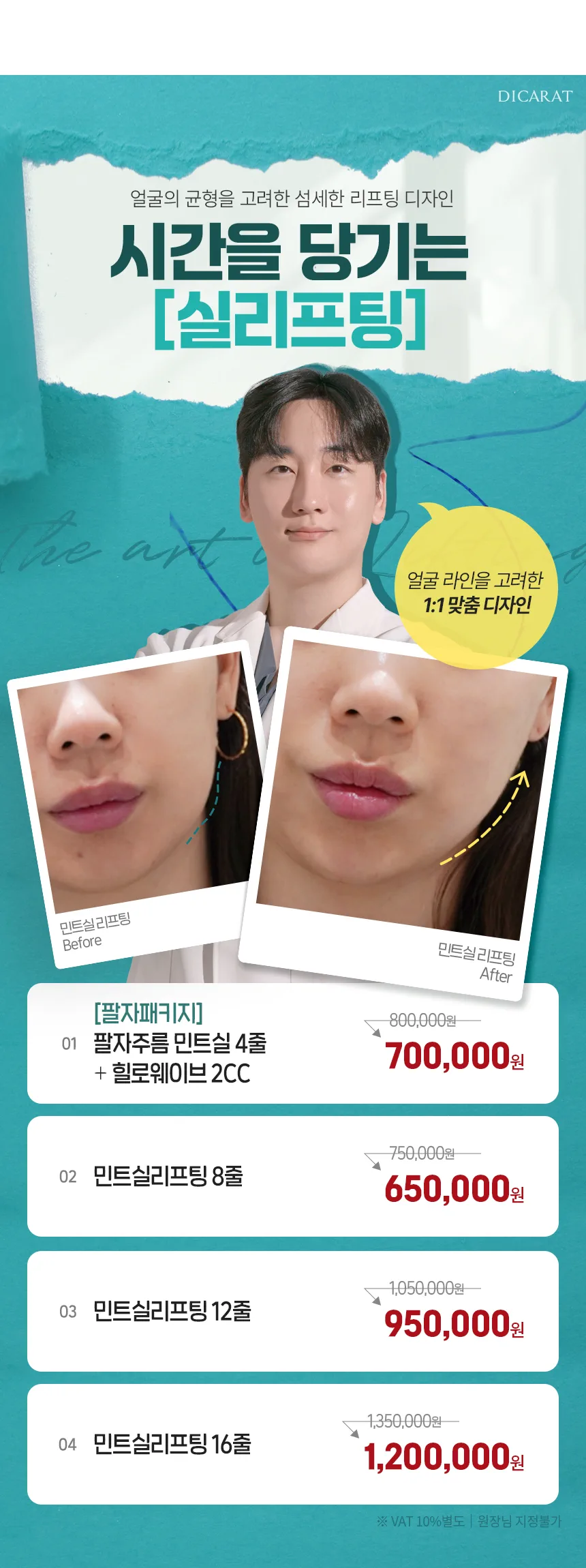 디캐럿의원 신사본점 :: [11월] 실리프팅 EVENT