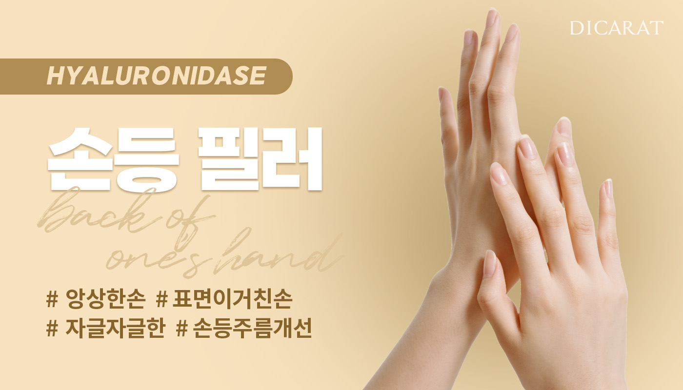 디캐럿의원 신사본점 :: 손등 필러