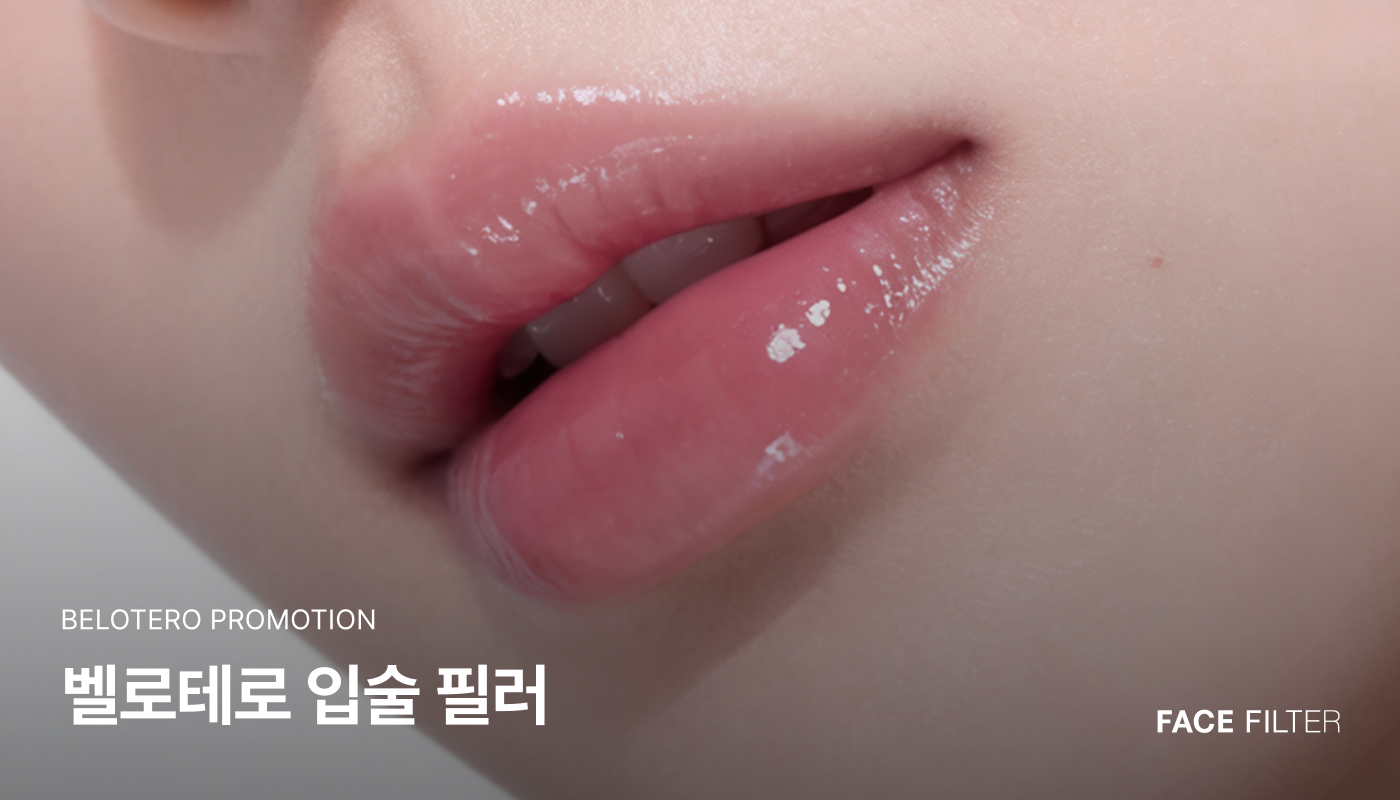 천호피부과 (진료과목)｜페이스필터의원 천호점 :: 벨로테로 필러(BELOTERO)