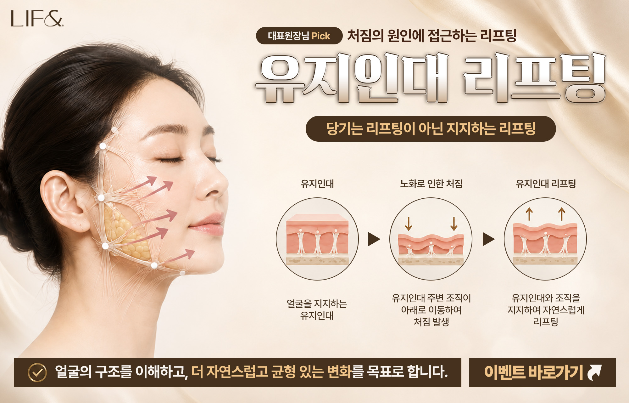 유지인대 리프팅