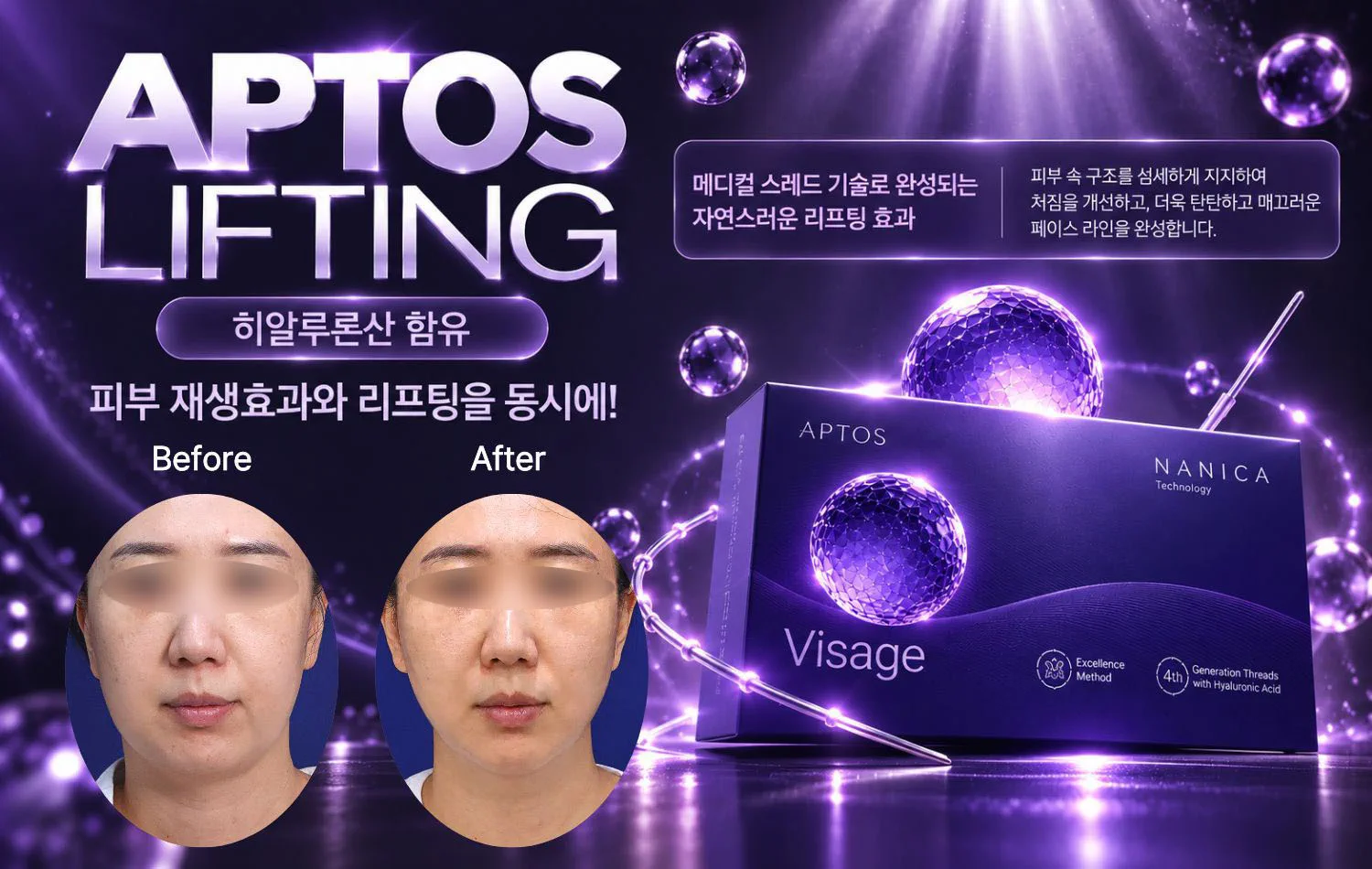 리프앤의원 창원점 :: 압토스 실리프팅