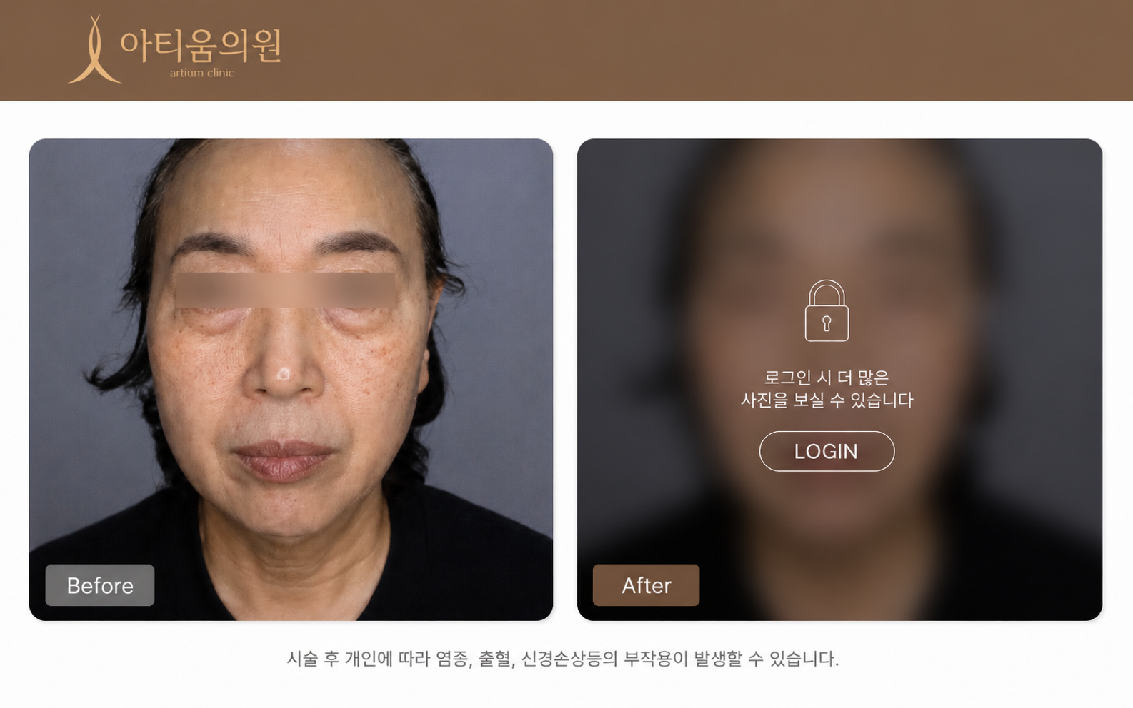 아티움의원 :: 트윙클라인패키지