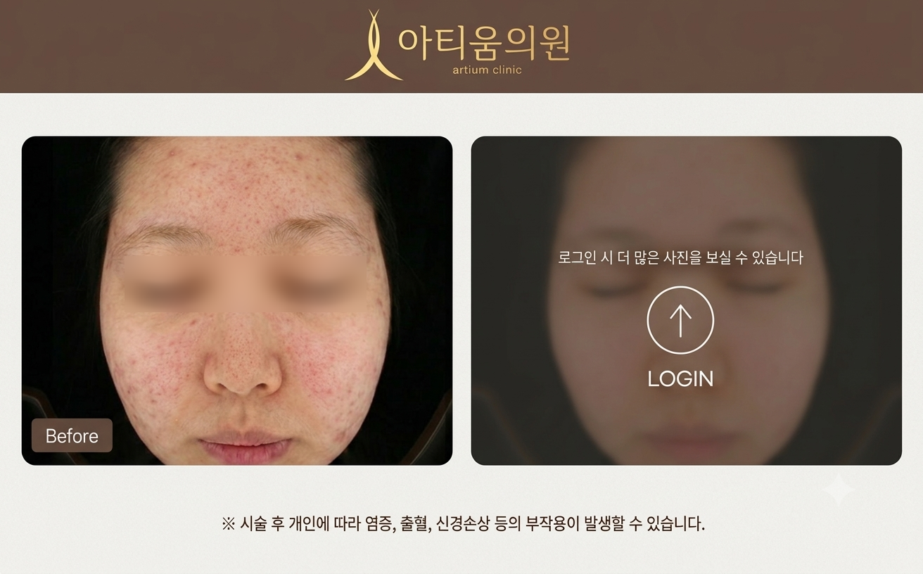 아티움의원 :: 커스텀올인원