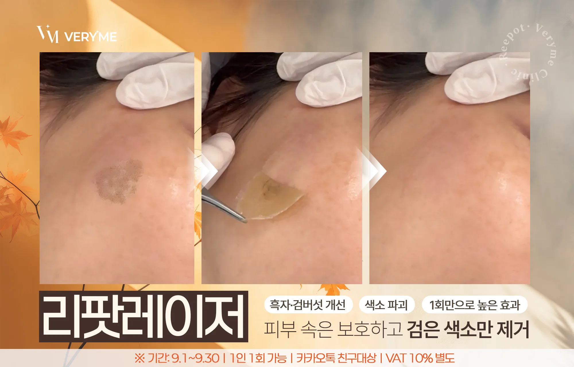 리팟 시그니처 케어