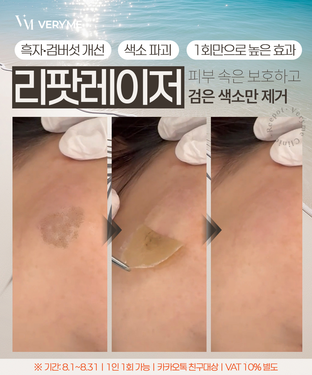 NEW 리팟 시그니처 케어
