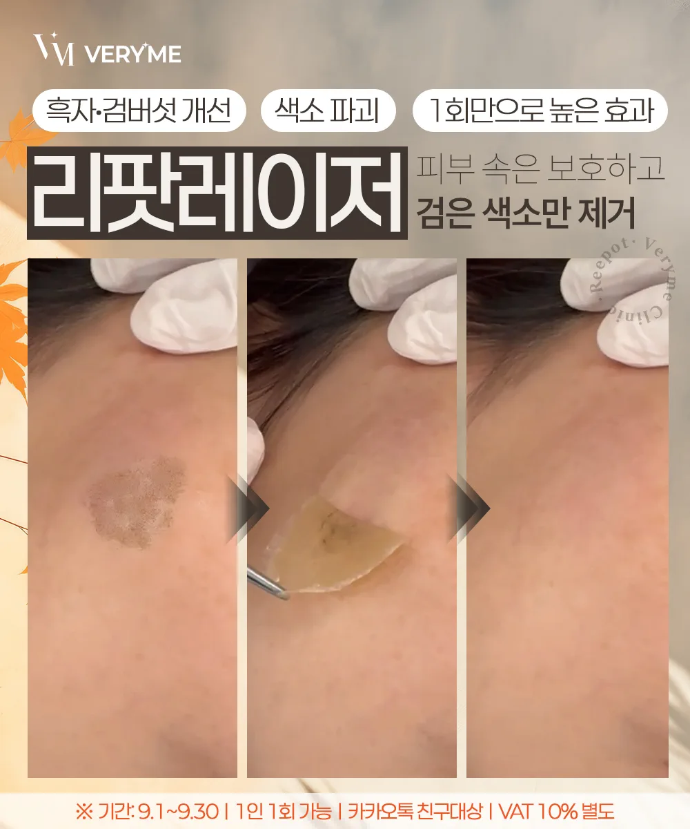 NEW 리팟 시그니처 케어