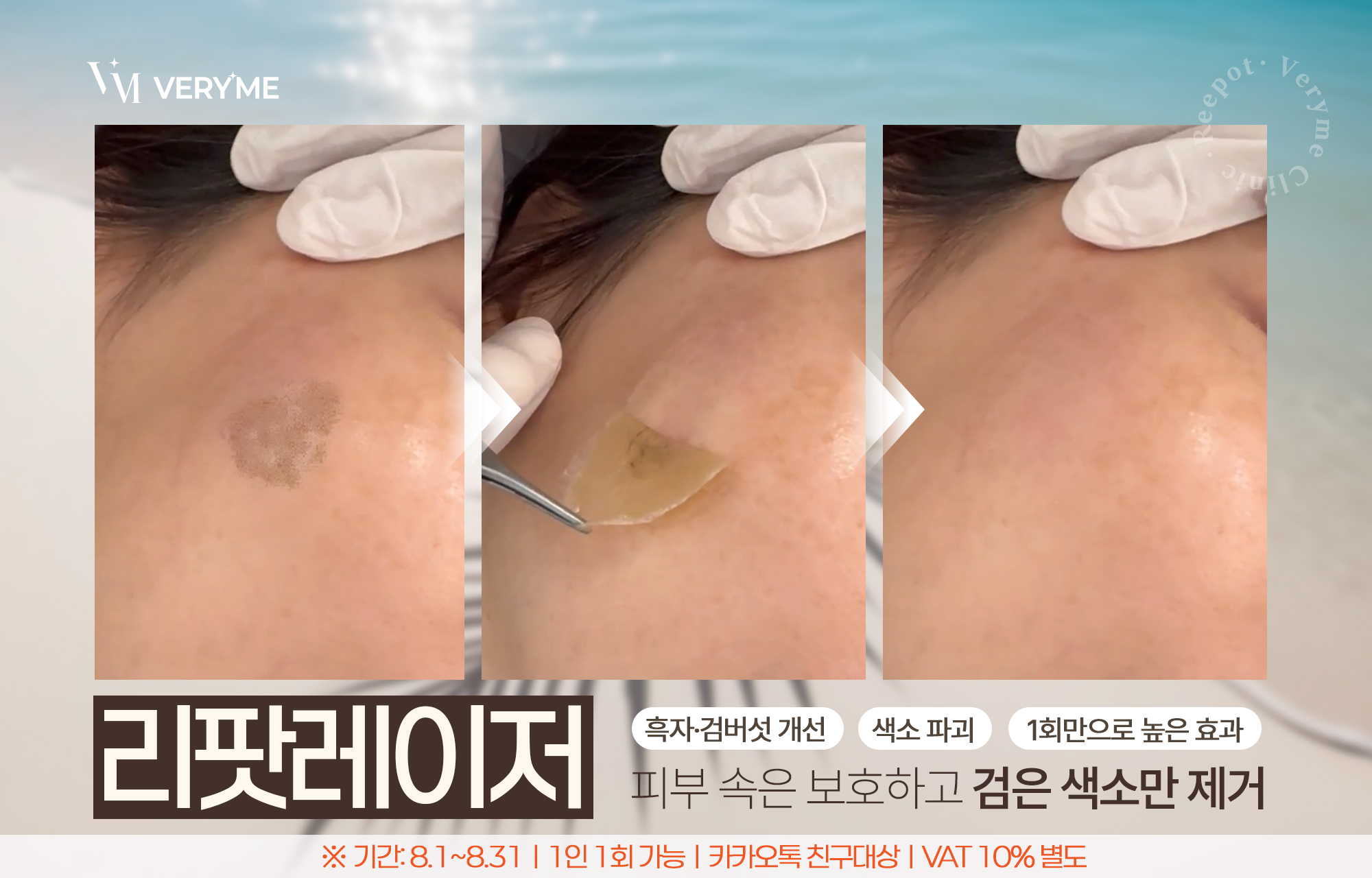 NEW 리팟 시그니처 케어